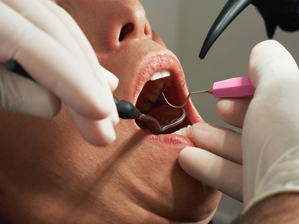 A dentist examines a patient's mouth