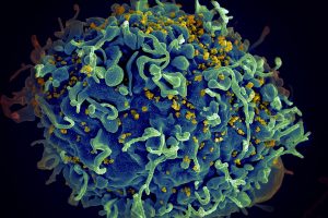 HIV, the Aids virus (yellow), infecting a human cell (credit National Cancer Institute via Unsplash)